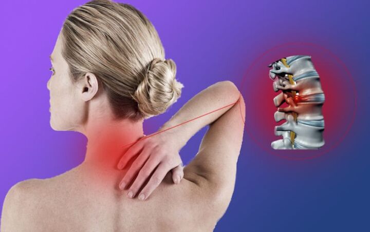 Osteochondrose der Halswirbelsäule führt zur Entwicklung von Zwischenwirbelhernien