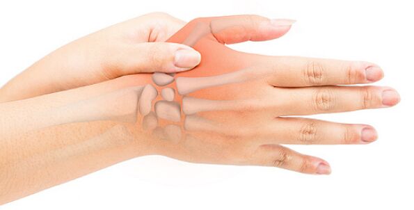 Eine stenosierende Ligamentitis blockiert den Finger in einer gebeugten Position