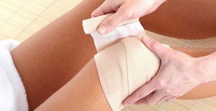 Kompresse am Knie bei Arthritis und Arthrose